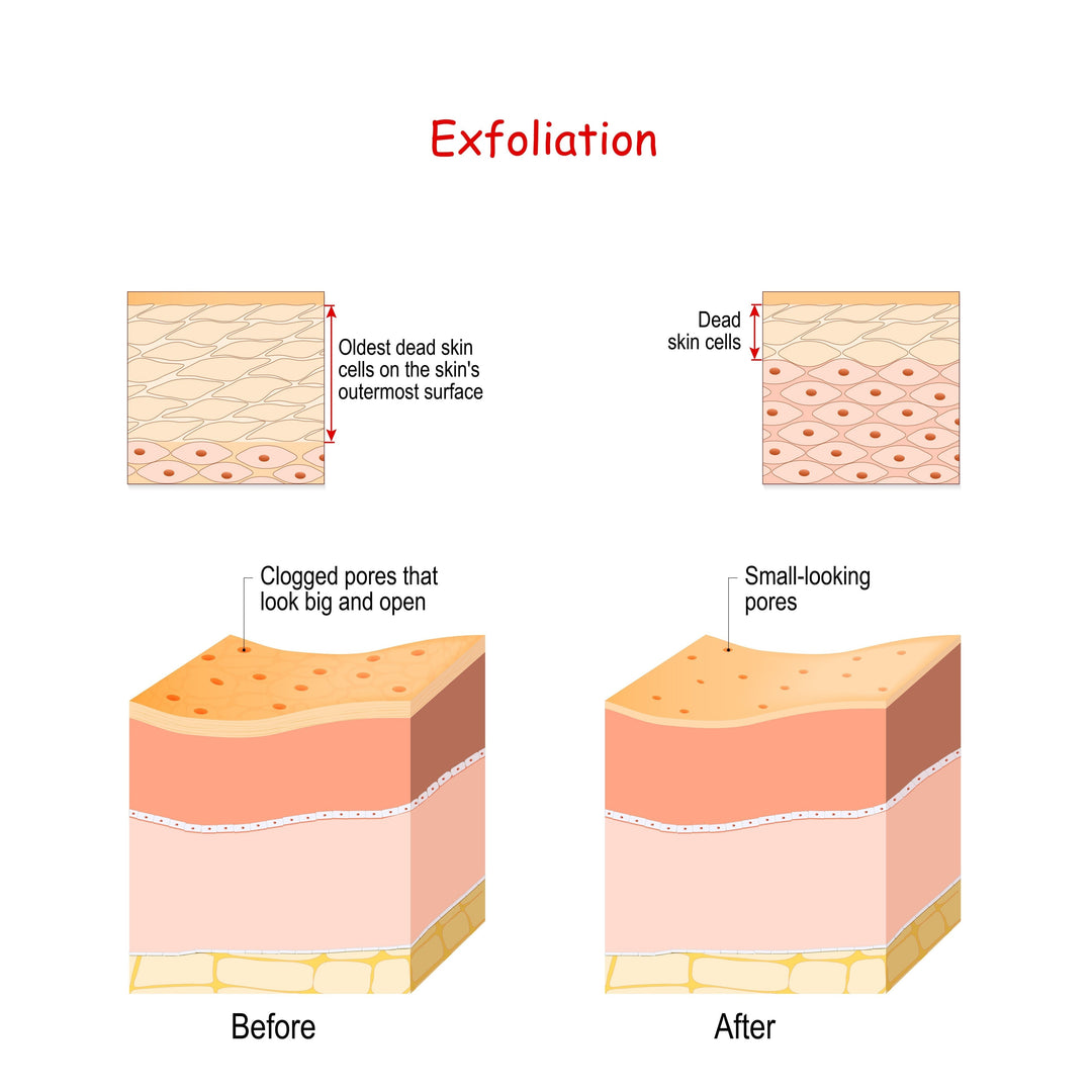 Glycolic acid or Mandelic acid: What's best for skin of colour?