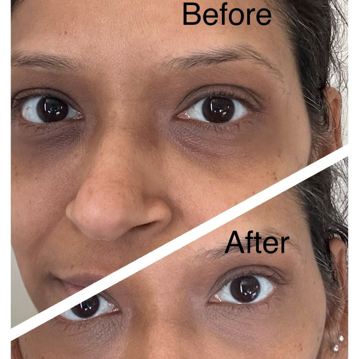 Dr V Dark Circles Kit user photos