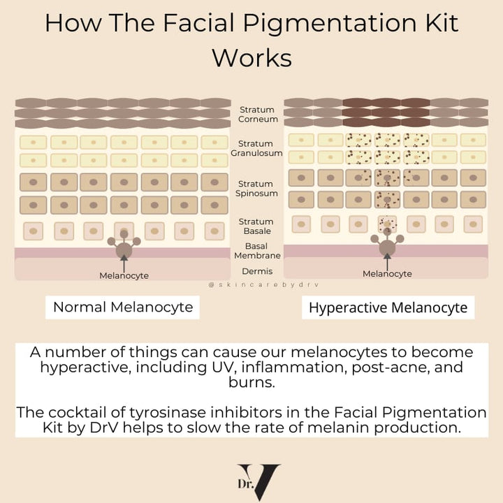 Facial Pigmentation Kit